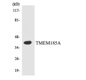 Western Blot - Anti-TMEM185A Antibody (R12-3631) - Antibodies.com