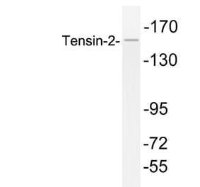 Western Blot - Anti-Tensin-2 Antibody (R12-2379) - Antibodies.com