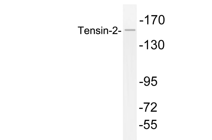 Western Blot - Anti-Tensin-2 Antibody (R12-2379) - Antibodies.com