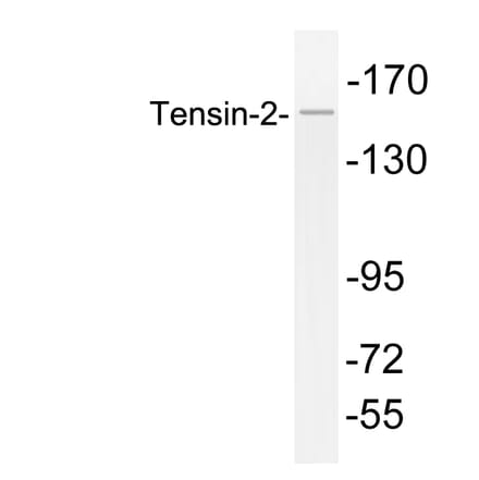 Western Blot - Anti-Tensin-2 Antibody (R12-2379) - Antibodies.com
