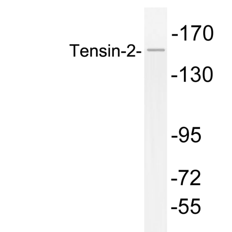 Western Blot - Anti-Tensin-2 Antibody (R12-2379) - Antibodies.com