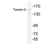 Western Blot - Anti-Tensin-2 Antibody (R12-2379) - Antibodies.com