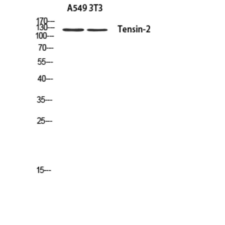 Western Blot - Anti-Tensin-2 Antibody (R12-2379) - Antibodies.com