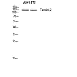 Western Blot - Anti-Tensin-2 Antibody (R12-2379) - Antibodies.com