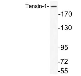 Western Blot - Anti-Tensin-1 Antibody (R12-2378) - Antibodies.com