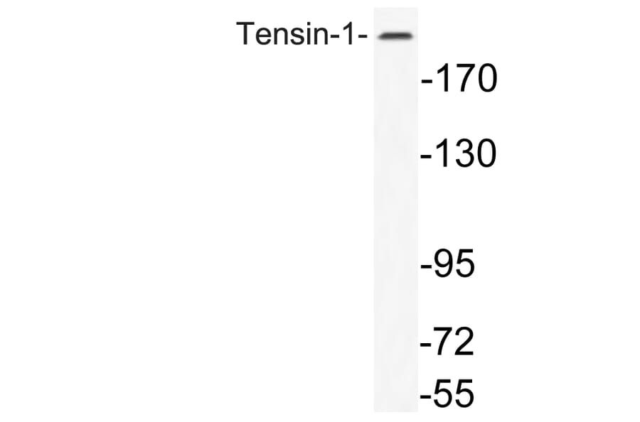 Western Blot - Anti-Tensin-1 Antibody (R12-2378) - Antibodies.com