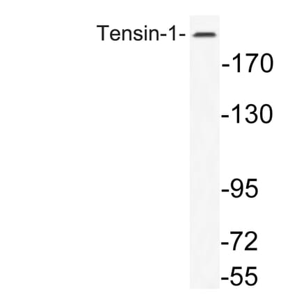 Western Blot - Anti-Tensin-1 Antibody (R12-2378) - Antibodies.com