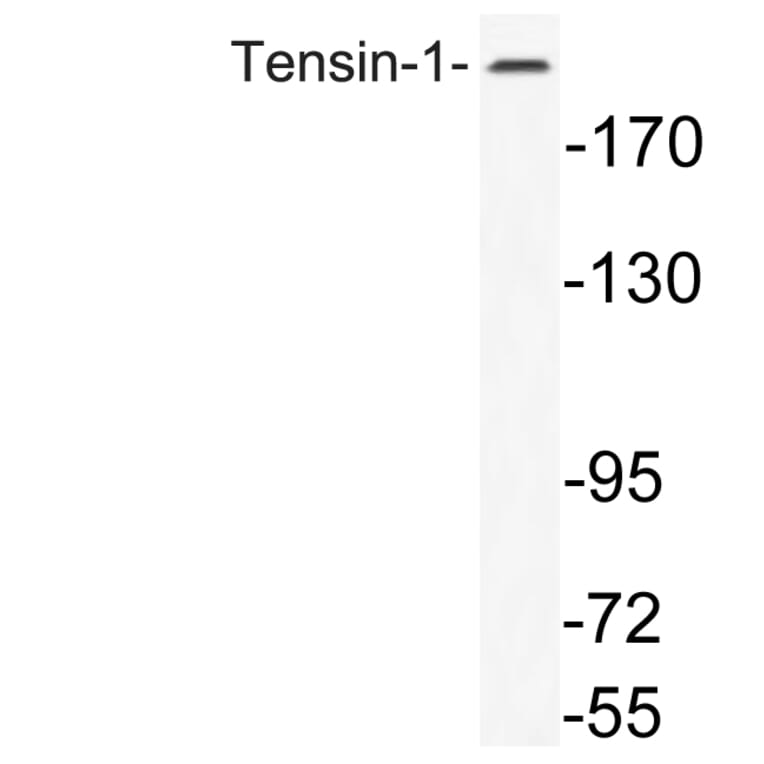 Western Blot - Anti-Tensin-1 Antibody (R12-2378) - Antibodies.com