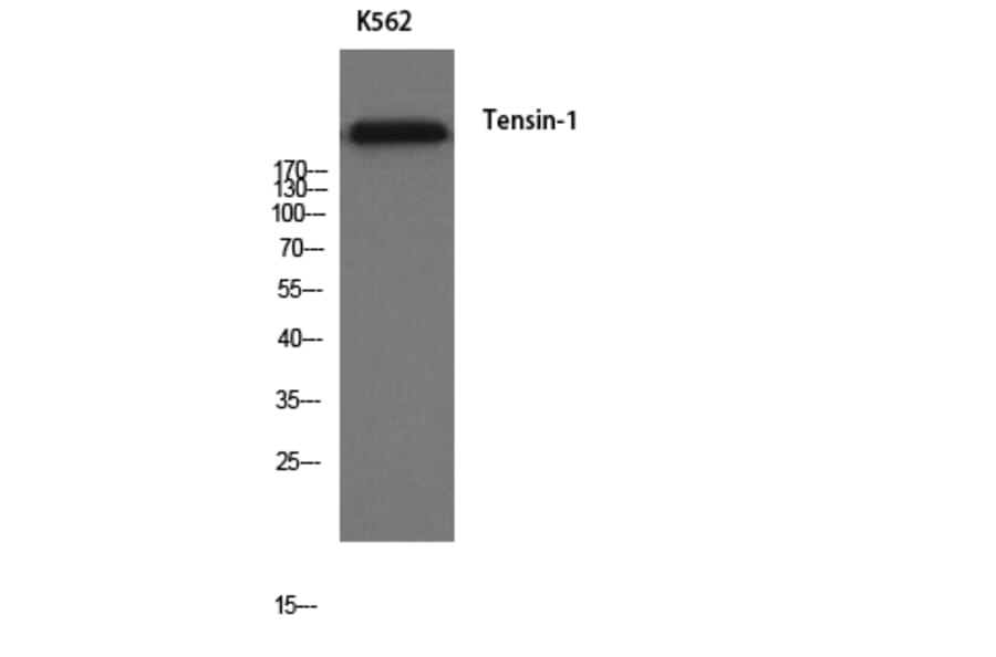 Western Blot - Anti-Tensin-1 Antibody (R12-2378) - Antibodies.com