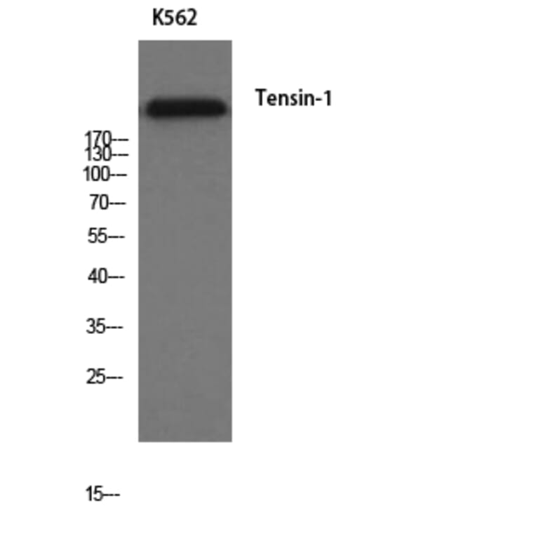 Western Blot - Anti-Tensin-1 Antibody (R12-2378) - Antibodies.com