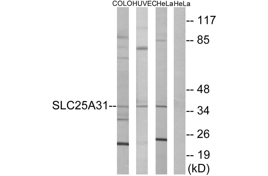Western Blot - Anti-SLC25A31 Antibody (C14335) - Antibodies.com