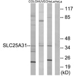 Western Blot - Anti-SLC25A31 Antibody (C14335) - Antibodies.com