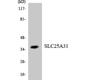 Western Blot - Anti-SLC25A31 Antibody (R12-3521) - Antibodies.com