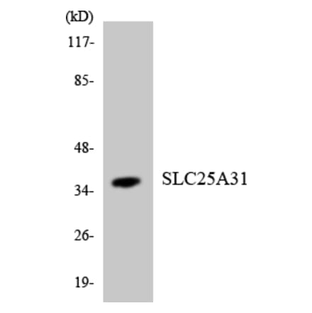 Western Blot - Anti-SLC25A31 Antibody (R12-3521) - Antibodies.com