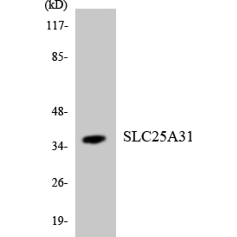 Western Blot - Anti-SLC25A31 Antibody (R12-3521) - Antibodies.com