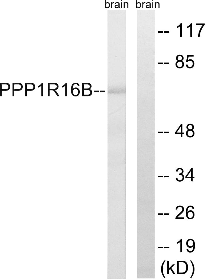 Western blot analysis of lysates from mouse brain using Anti-PPP1R16B Antibody. The right hand lane represents a negative control, where the antibody is blocked by the immunising peptide.