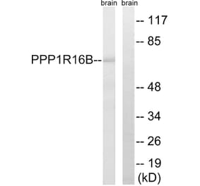 Western Blot - Anti-PPP1R16B Antibody (C18003) - Antibodies.com