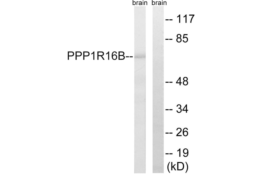 Western Blot - Anti-PPP1R16B Antibody (C18003) - Antibodies.com