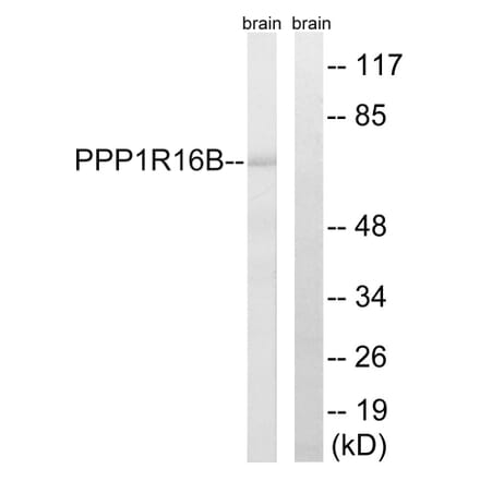 Western Blot - Anti-PPP1R16B Antibody (C18003) - Antibodies.com