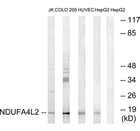 Western Blot - Anti-NDUFA4L2 Antibody (C16822) - Antibodies.com