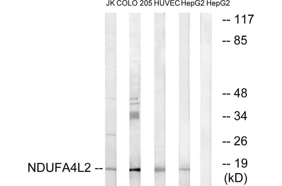 Western Blot - Anti-NDUFA4L2 Antibody (C16822) - Antibodies.com