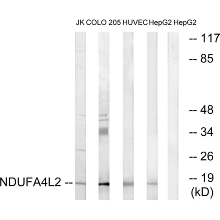 Western Blot - Anti-NDUFA4L2 Antibody (C16822) - Antibodies.com