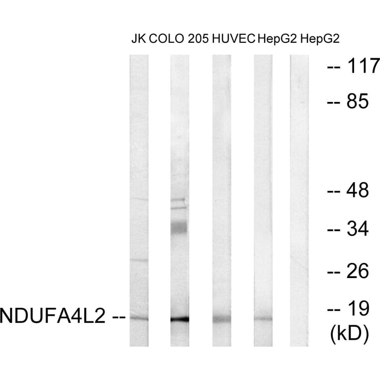 Western Blot - Anti-NDUFA4L2 Antibody (C16822) - Antibodies.com