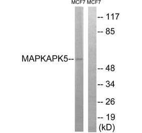 Western Blot - Anti-MAPKAPK5 Antibody (B8364) - Antibodies.com