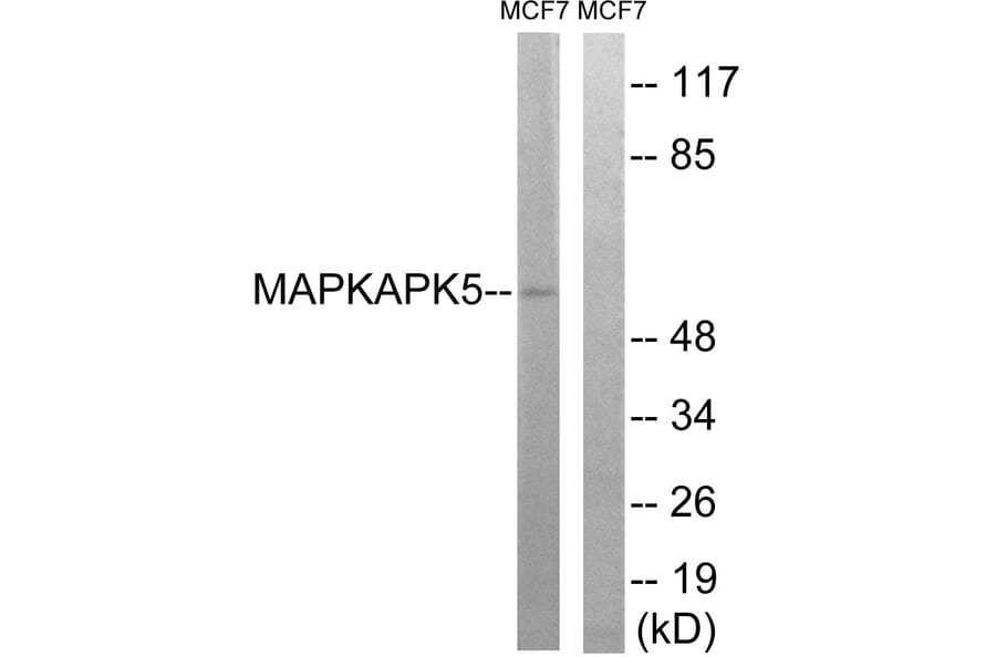 Western Blot - Anti-MAPKAPK5 Antibody (B8364) - Antibodies.com