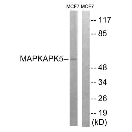 Western Blot - Anti-MAPKAPK5 Antibody (B8364) - Antibodies.com