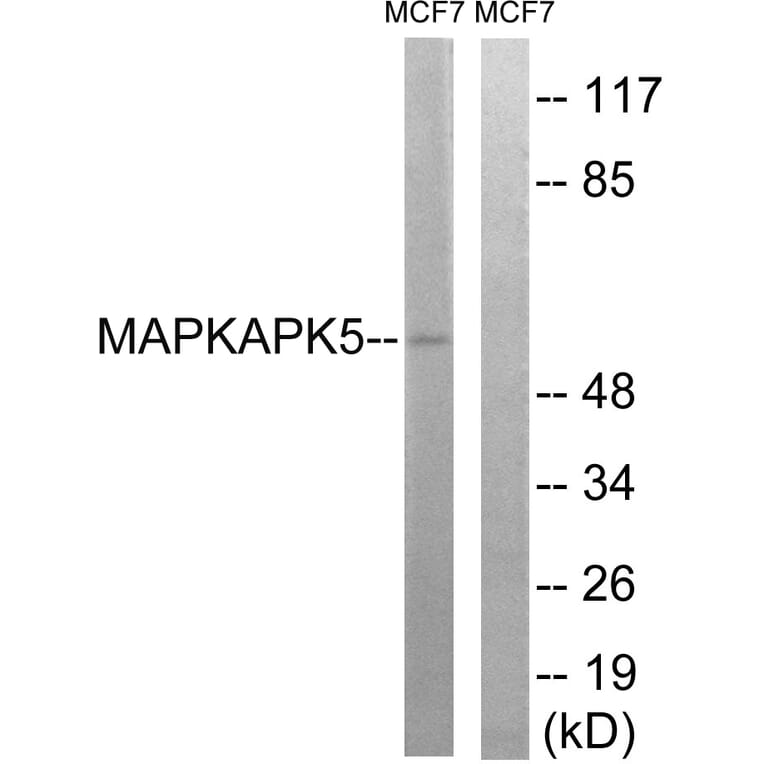 Western Blot - Anti-MAPKAPK5 Antibody (B8364) - Antibodies.com
