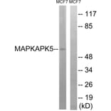 Western Blot - Anti-MAPKAPK5 Antibody (B8364) - Antibodies.com