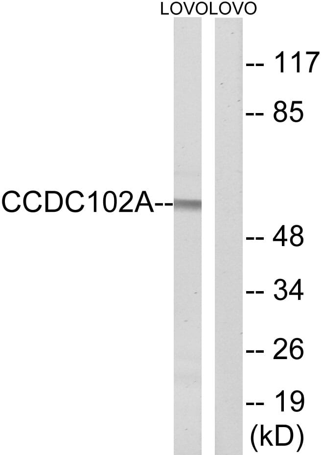 Western blot analysis of lysates from LOVO cells using Anti-CCDC102A Antibody. The right hand lane represents a negative control, where the antibody is blocked by the immunising peptide.