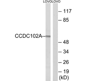 Western Blot - Anti-CCDC102A Antibody (C15185) - Antibodies.com