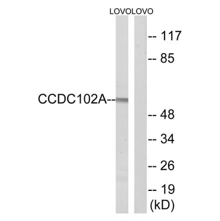 Western Blot - Anti-CCDC102A Antibody (C15185) - Antibodies.com
