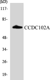 Western blot analysis of the lysates from HepG2 cells using Anti-CCDC102A Antibody.