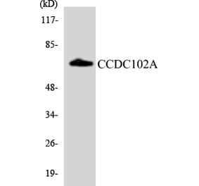 Western Blot - Anti-CCDC102A Antibody (R12-2574) - Antibodies.com