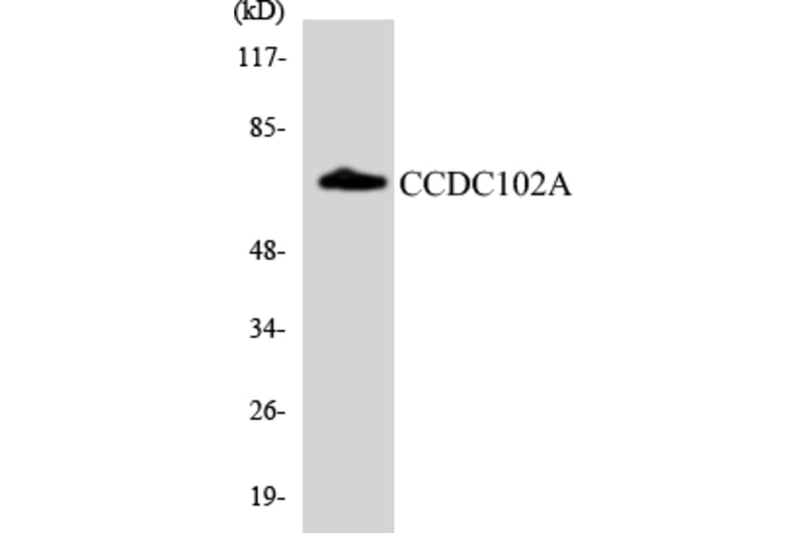 Western Blot - Anti-CCDC102A Antibody (R12-2574) - Antibodies.com