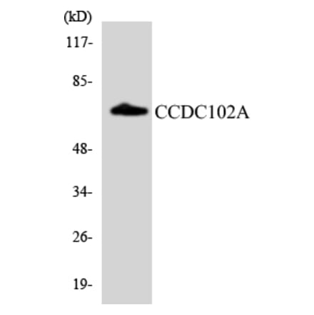 Western Blot - Anti-CCDC102A Antibody (R12-2574) - Antibodies.com