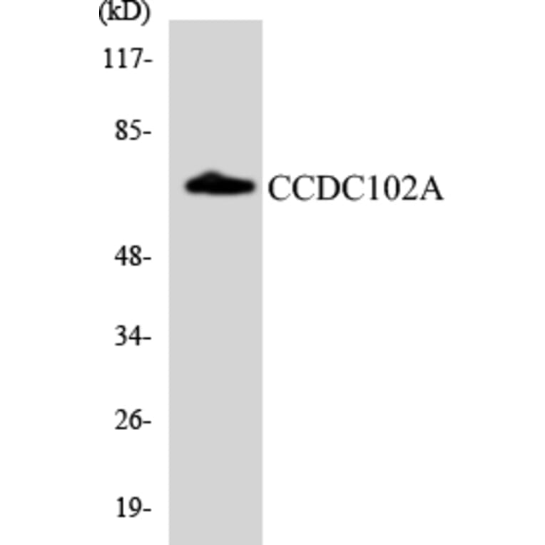 Western Blot - Anti-CCDC102A Antibody (R12-2574) - Antibodies.com