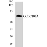 Western Blot - Anti-CCDC102A Antibody (R12-2574) - Antibodies.com