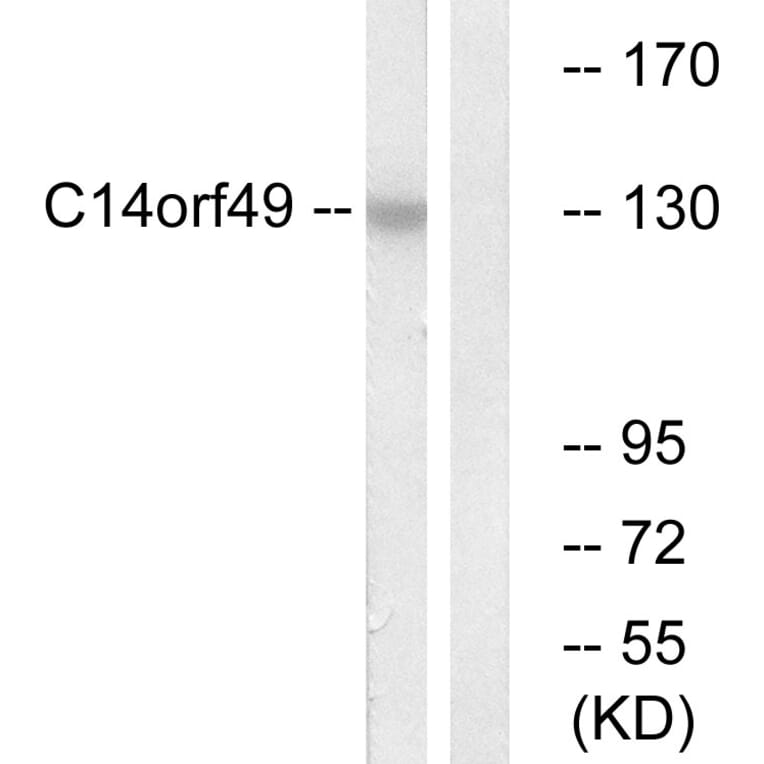 Western Blot - Anti-C14orf49 Antibody (C16888) - Antibodies.com