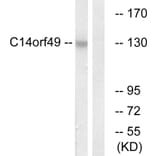 Western Blot - Anti-C14orf49 Antibody (C16888) - Antibodies.com
