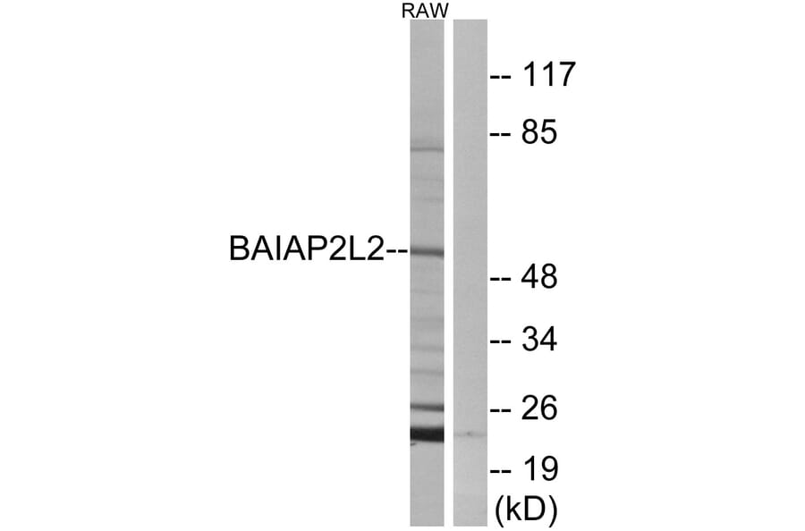 Western Blot - Anti-BAIAP2L2 Antibody (C14788) - Antibodies.com