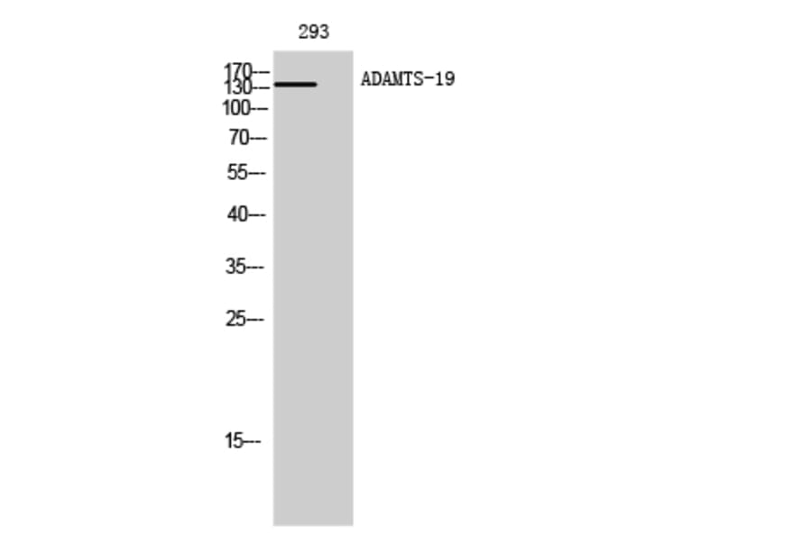 Western Blot - Anti-ADAMTS19 Antibody (C14311) - Antibodies.com