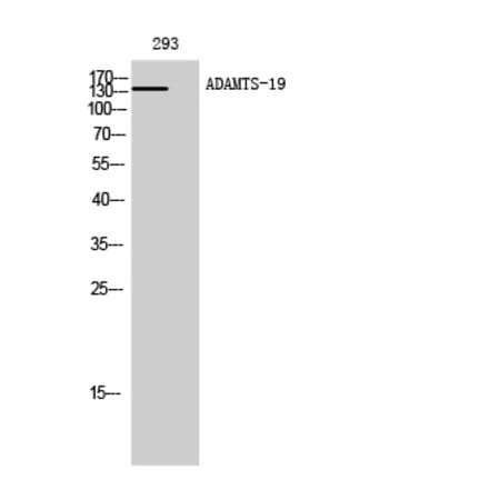 Western Blot - Anti-ADAMTS19 Antibody (C14311) - Antibodies.com