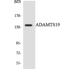 Western Blot - Anti-ADAMTS19 Antibody (R12-2445) - Antibodies.com