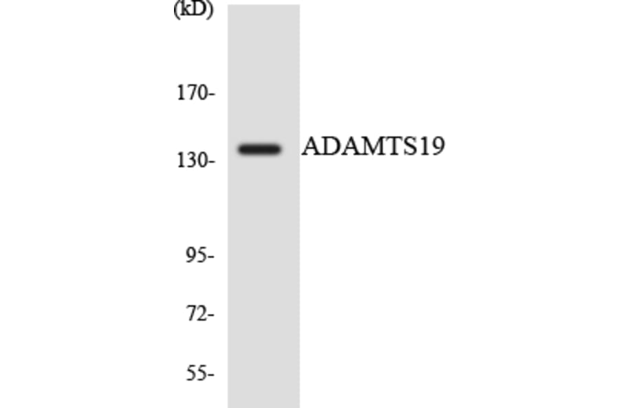 Western Blot - Anti-ADAMTS19 Antibody (R12-2445) - Antibodies.com
