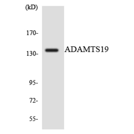 Western Blot - Anti-ADAMTS19 Antibody (R12-2445) - Antibodies.com