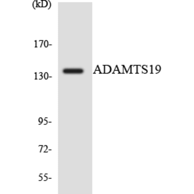 Western Blot - Anti-ADAMTS19 Antibody (R12-2445) - Antibodies.com